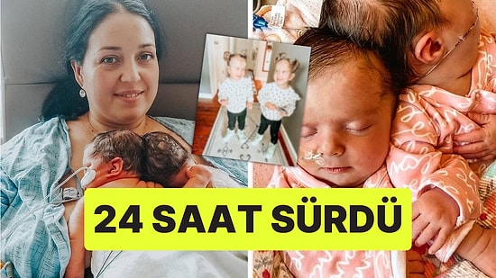 Doktorlar Öleceğini Söylemiş: Ameliyatla Ayrılan Siyam İkizlerinin Son Halini Paylaşan Anne İçimizi Isıttı