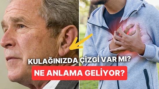 Neden Bazı İnsanların Kulak Memesinde İnce Bir Çizgi Var?