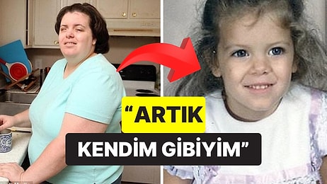 Kör Olmayı Takıntı Haline Getirdi: Küçüklüğünden Beri Kör Olmak İsteyip Gözlerine Kimyasal Madde Döken Kadın