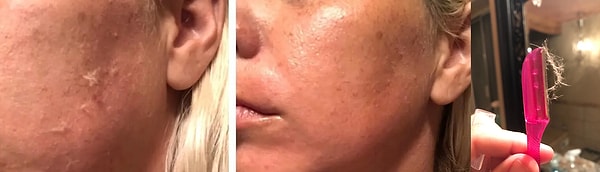 Schick Hydro Silk Şık İpek Rötuş Çok Amaçlı Peeling & Dermaplaning Aleti
