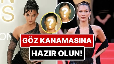 Göz Kanamasına Hazır Olun: Kylie Jenner'dan Hailey Bieber'a Hollywood Ünlüleri Estetiksiz Nasıl Gözükürdü?