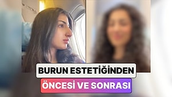 Günümüzde estetik operasyonlar oldukça yaygınlaştı. Eskiden sadece belirli bir kesim tarafından tercih edilen bu operasyonlar, artık toplumun geniş kesimlerine yayılmış durumda. Estetik operasyonlar, kişinin kendisini daha iyi hissetmesini sağlayan, özgüvenini artıran ve yaşam kalitesini yükselten bir yol olarak görülüyor.