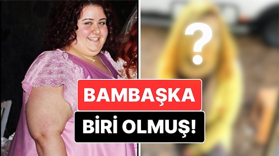 Hercai'nin 'Melike'siydi: Mide Küçültme Ameliyatı Olup 110 Kilo Veren Aslı Samat'ın Son Hali Şok Etti!