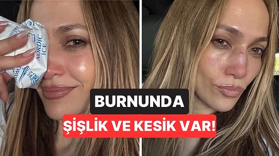Jennifer Lopez Prova Esnasında Düşerek Yaralandı: Hayranlarının Yüreğini Ağzına Getirdi!