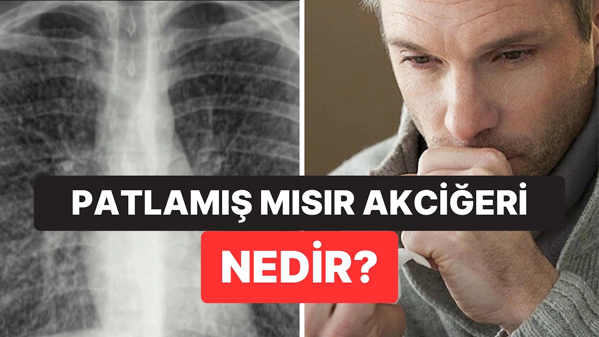 Sigaralar Sebep Oluyor: &quot;Patlamış Mısır Akciğeri&quot; Olarak Bilinen Rahatsızlığı Daha Önce Duymuş muydunuz?