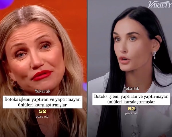 Hollywood’un iki efsane ismi, ama iki zıt estetik hikayesi! Bir yanda doğallığıyla yıllara meydan okumak yerine onları kucaklayan Cameron Diaz, diğer yanda gençlik ısrarından asla vazgeçmeyen Demi Moore var.