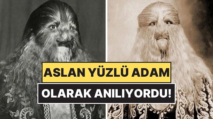 Yarım Asırlık Efsane: Aslan Yüzlü Adam Stephan Bibrowski'nin Hikayesi