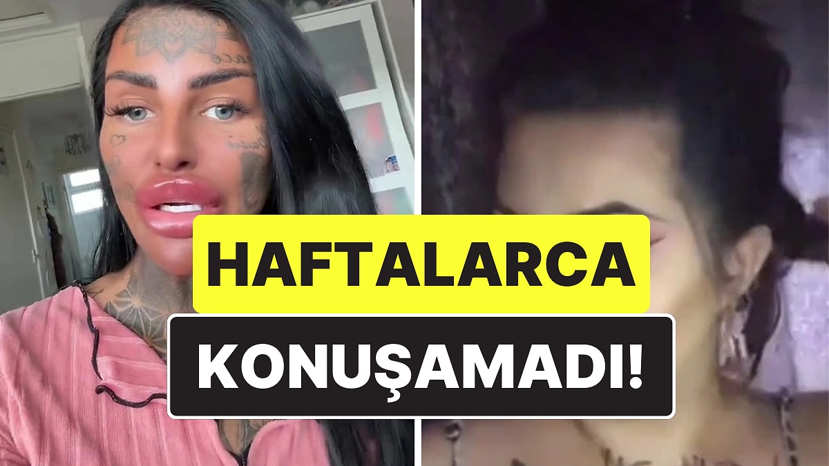 Estetik Takıntısı Pahalıya Patladı: Dilini İkiye Böldürdükten Sonra Konuşma Yetisini Kaybeden Kadın