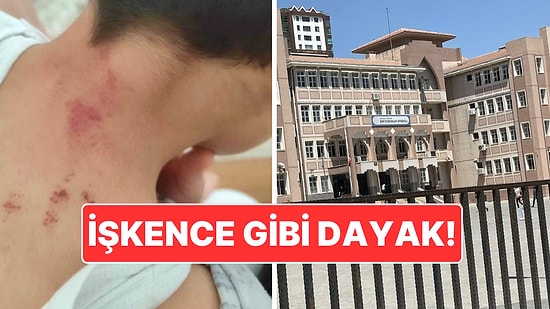 10 Yaşındaki Öğrenciye İşkence Gibi Dayak: Sınıf Öğretmeni Tutuklandı