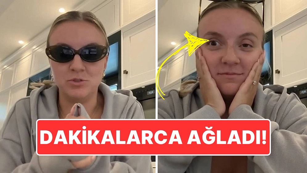 İkinci Kez Botoks Yaptıran İçerik Üreticisi Hayatının Pişmanlığını Yaşadı: Göz Kapaklarını Kontrol Edemiyor