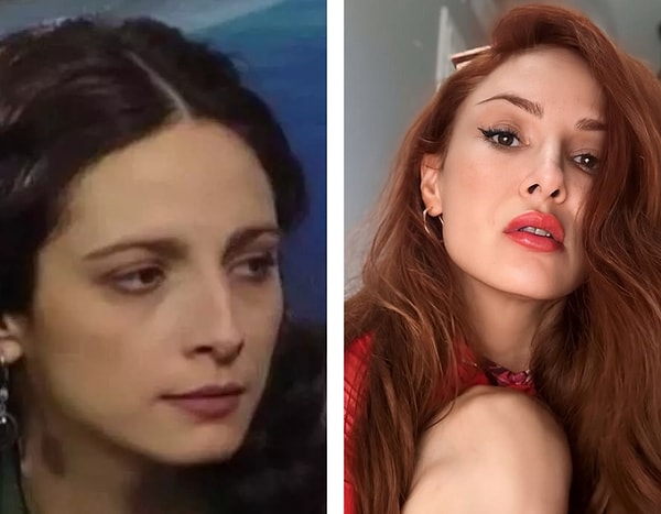 Elmacık Kemikleri