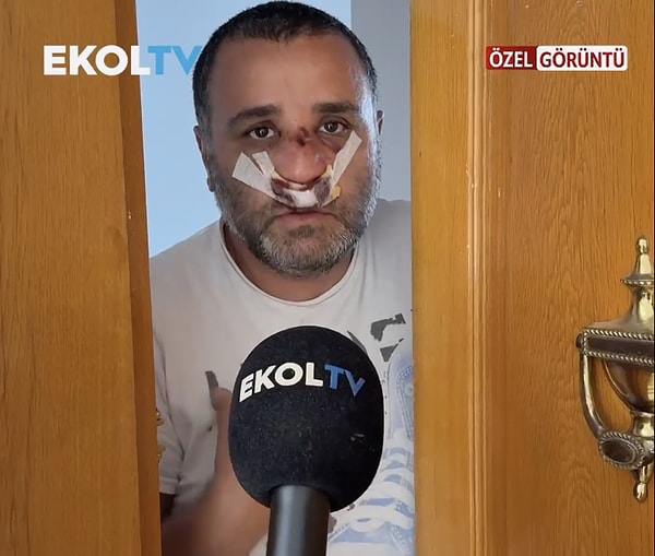 Saldırıya uğrayan Deniz Eroğlu, Marmaray'da yaşananları anlattı.