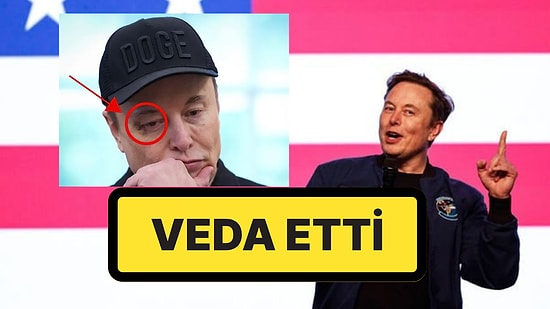 Donald Trump, Elon Musk'a Veda Etti: Elon Musk'ın Morarmış Gözü Dikkat Çekti