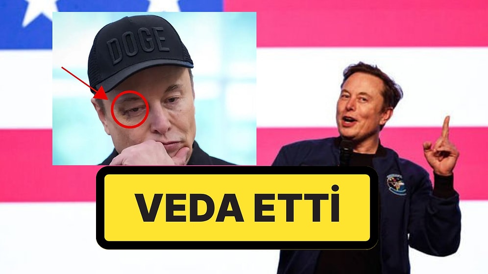 Donald Trump, Elon Musk'a Veda Etti: Elon Musk'ın Morarmış Gözü Dikkat Çekti