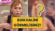 Bambaşka Biri Olmuş: Kısmetse Olur Şeydanur'un Son Halini Görenler Tanımakta Güçlük Çekti!