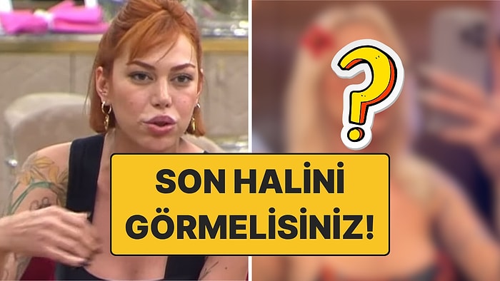 Bambaşka Biri Olmuş: Kısmetse Olur Şeydanur'un Son Halini Görenler Tanımakta Güçlük Çekti!