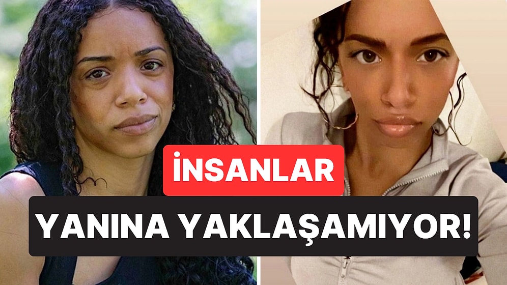 Duş Alsa da Geçmiyor: Nadir Bir Hastalık Nedeniyle Ölü Balık ve Ter Kokan Kadının İbretlik Hikayesi