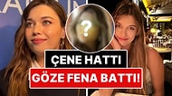 Çene Hattındaki Değişim Gözlerden Kaçmadı: Afra Saraçoğlu'nun Yüzüne Yaptırdığı Estetik İşlem Dikkat Çekti!