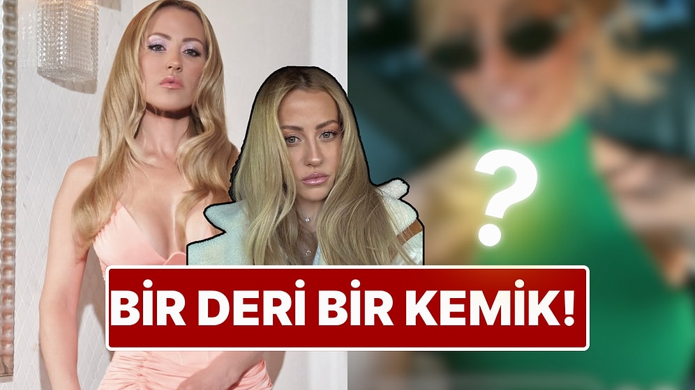 Bir Deri Bir Kemik: Zayıflığıyla Sevenlerini Endişelendiren Derya Uluğ'dan Kilo Açıklaması Geldi!