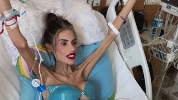 Son dönemlerin en çok konuşulan isimlerinden bir tanesi olan Nihal Candan anoreksiyayla yaşam mücadelesinde 23 kiloya kadar düşmüştü. Görseli