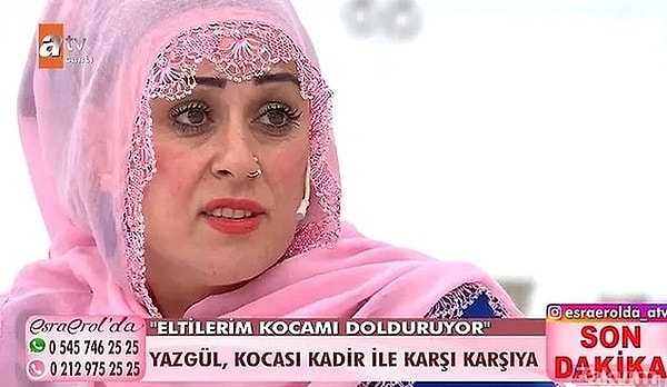 4. Esra Erol'un programında fenomen olan Yazgül şimdilerde ise yeni bir hamleyle gündemde: Saç ekimi.