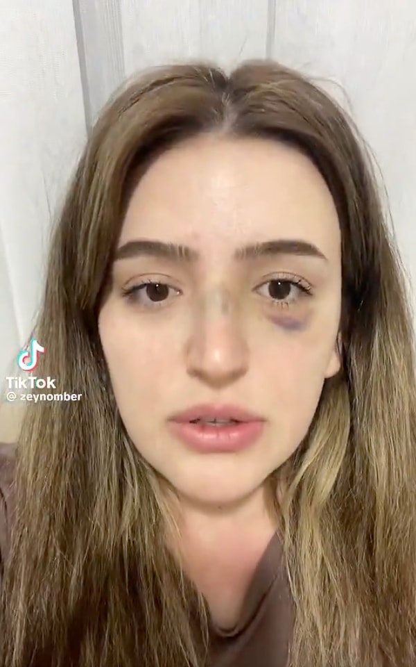 Sosyal medyada paylaşılan bir videoda “Zeynep” isimli vatandaş, gördüğü aile içi şiddetten bahsetti.