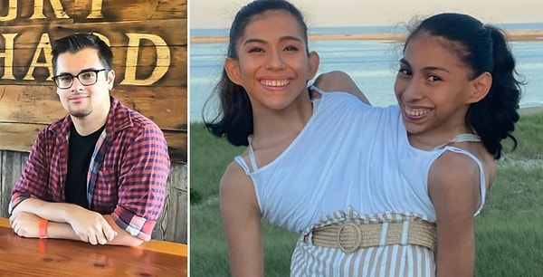 25 yaşındaki Carmen ve Lupita Andrade, gövdelerinden yapışık şekilde dünyaya geldi.