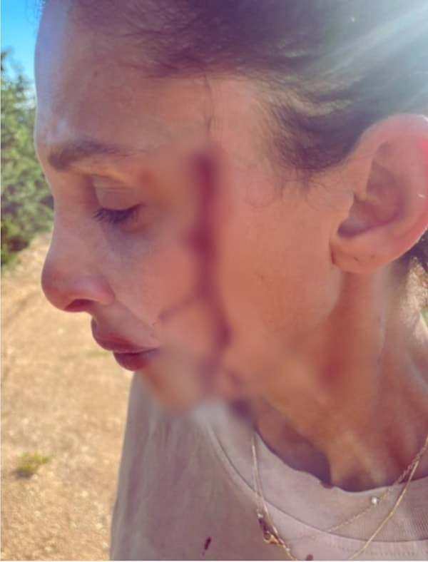 Can Yaman'ın yeni sevgilisi Sara Bluma çocuğunun babasından şiddet gördüğünü açıkladı.