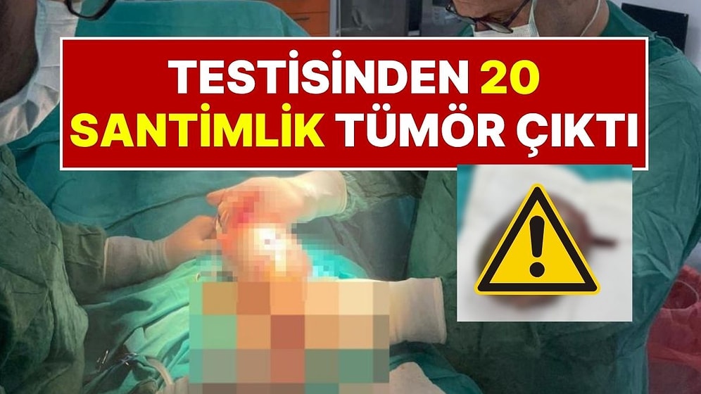 Testisinde 20 Santimlik Tümör Çıkan 66 Yaşındaki Adam Ameliyata Alındı