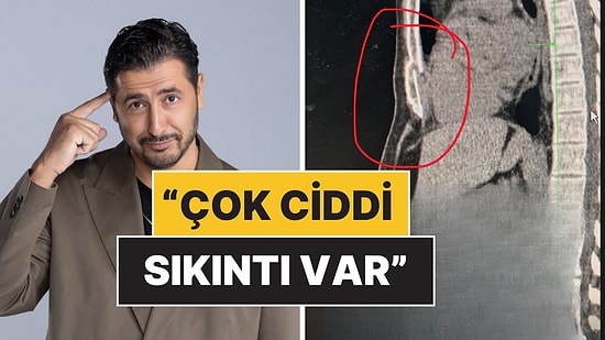 Karadağ'da Geçirdiği Kazada Göğüs Kemiği Kırılan Taner Çağlı Sağlık Sistemine Tepki Gösterdi