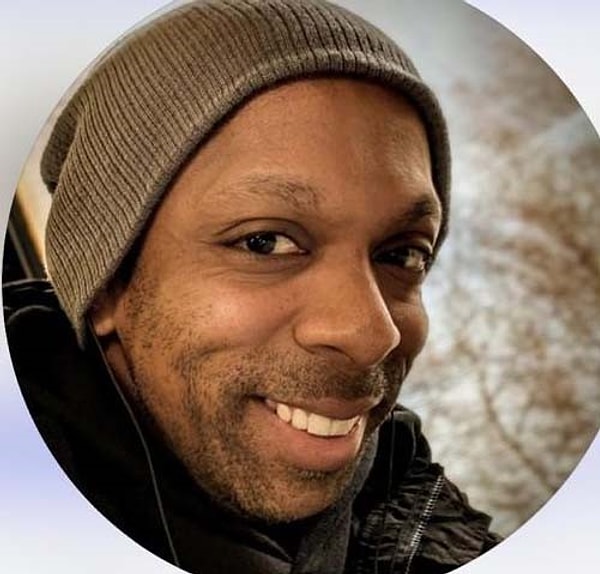 İddiaya göre, İngiltere'de yaşayan Martyn James Latchman (38), saç ektirmek için İstanbul'a geldi.