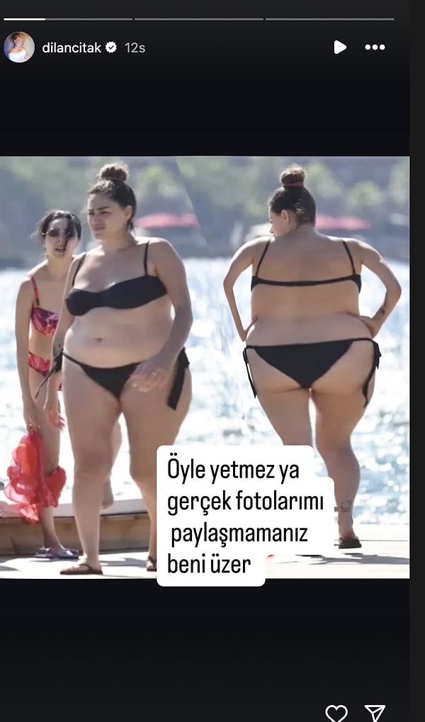 Bu kez magazincilerin çektiği bir fotoğraf nedeniyle öfkelendi!