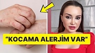 Kocasıyla Birlikte Olduktan Sonra Alerjik Reaksiyon Gösterdiğini İddia Eden Kadın