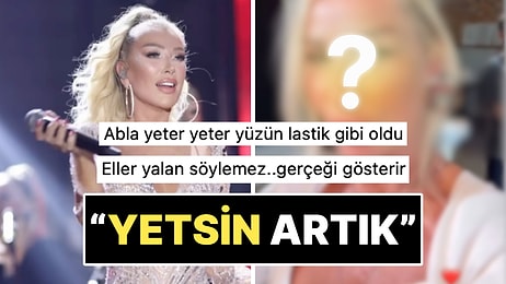 "Eller Yalan Söylemez": Yeni Yaptırdığı Estetikle Yüzünün Kalktığına İnanan Seda Sayan Son Halini Paylaştı!