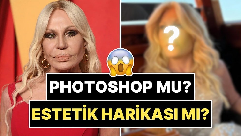 Yüzündeki Dolguları Eritip Kendini Baştan Yaratan 70 Yaşındaki Donatella Versace'nin Son Hali Şoka Soktu!