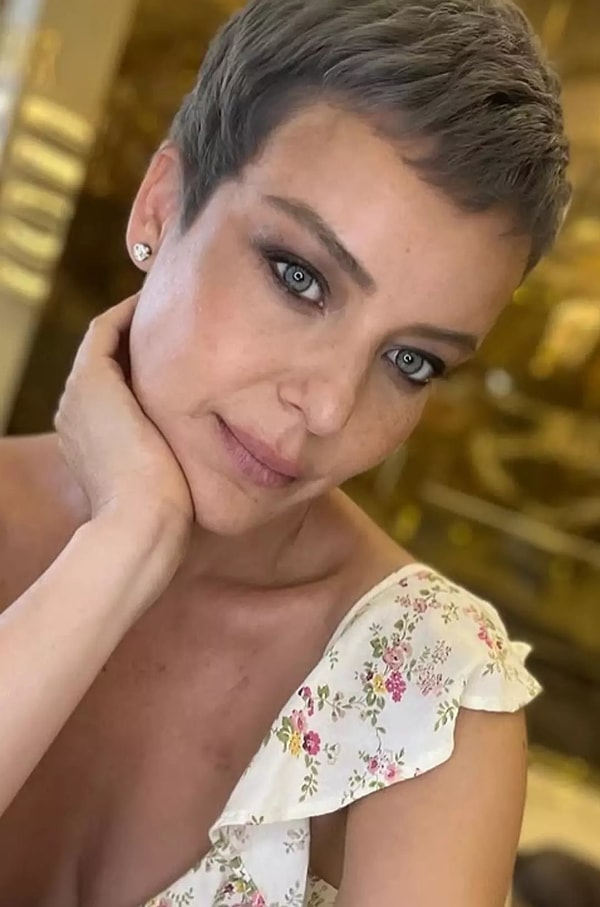 İşte Nursel Ergin'in Instagram'da paylaştığı son hali: