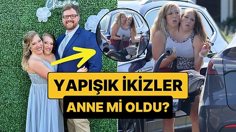Evlilikleriyle Gündem Olan Yapışık İkizler Abby ve Britanny Kucaklarında Bebekle Görüntülendi!
