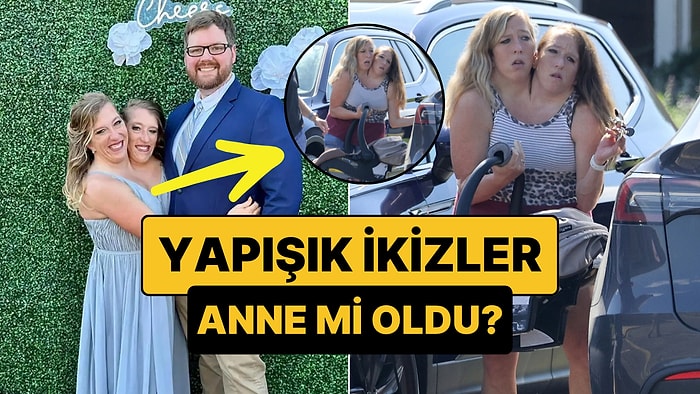 Evlilikleriyle Gündem Olan Yapışık İkizler Abby ve Britanny Kucaklarında Bebekle Görüntülendi!