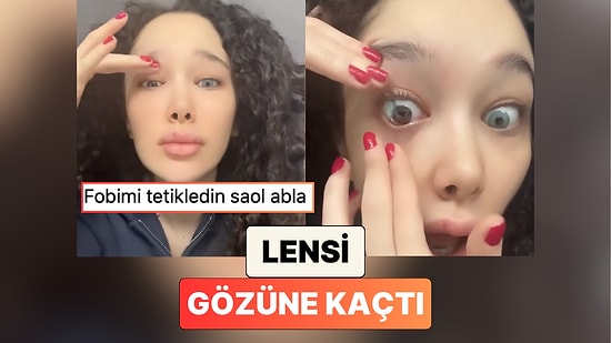 Yeni Fobi Hayırlı Olsun: Lensi Gözünün Arkasına Kaçan Kadın Yaşadığı Panik Anlarını Paylaştı
