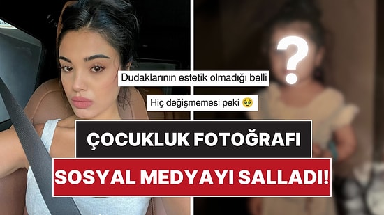 Çarpıntı’nın Yıldızı Lizge Cömert’in Çocukluk Fotoğrafı Estetik İddialarını Yıktı Geçti!