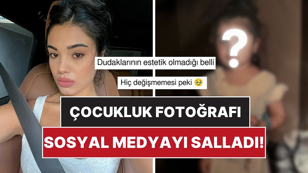 Çarpıntı’nın Yıldızı Lizge Cömert’in Çocukluk Fotoğrafı Estetik İddialarını Yıktı Geçti!