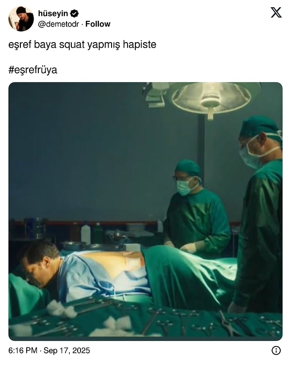 Yorum yok 😅😅