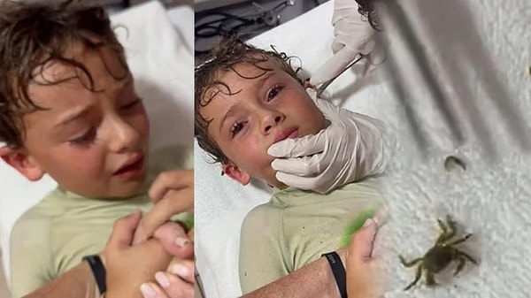 Sosyal medya fenomeni ve aynı zamanda da moda tasarımcısı olan Kitzia Mitre’nin oğlunun kulağından yengeç çıkarıldı.
