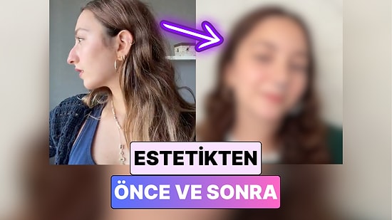 Burun Estetiği Nereye Gidiyor? Burun Estetiği Yaptıran Bir Kadın Yaşadığı Değişimi Paylaştı