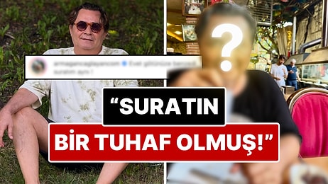 Armağan Çağlayan Paylaştığı Fotoğrafta Yüzünün Son Haline Bir Kullanıcının Yaptığı Yoruma Fena Sinirlendi!