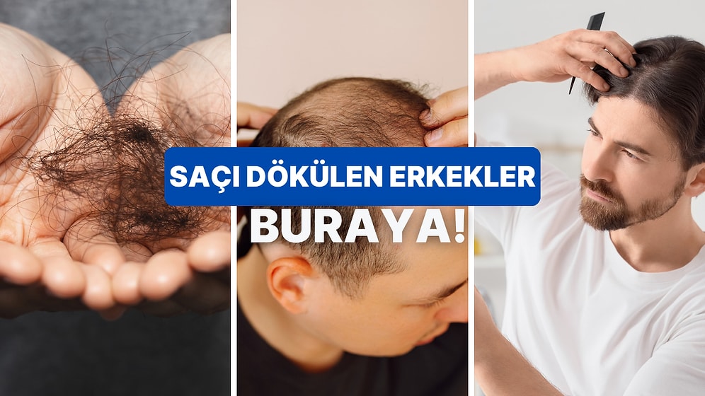Beyler Sizi Unutmadık! Erkek Tipi Saç Dökülmesine Karşı Etkili Çözümler