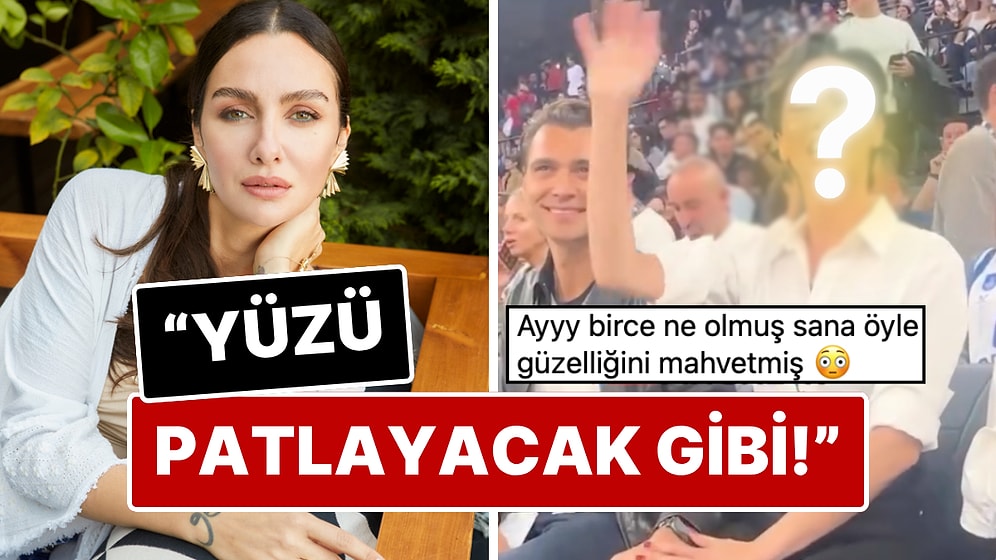 Estetik Dozu Kaçtı mı? Birce Akalay'ın Yüzünün Son Halini Görenler Eski Doğallığıyla Karşılaştırmadan Edemedi!