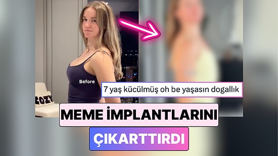 Doğallığa Dönüş Başlıyor: Yıllar Sonra Meme İmplantlarını Çıkartan İçerik Üreticisi Yaşadığı Değişimi Paylaştı