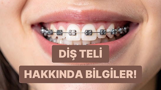 Diş Teli Üzerine Bilmeniz Gereken Her Şeyi Anlattık!