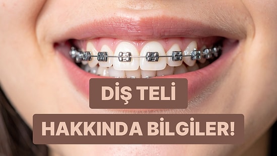 Diş Teli Üzerine Bilmeniz Gereken Her Şeyi Anlattık!